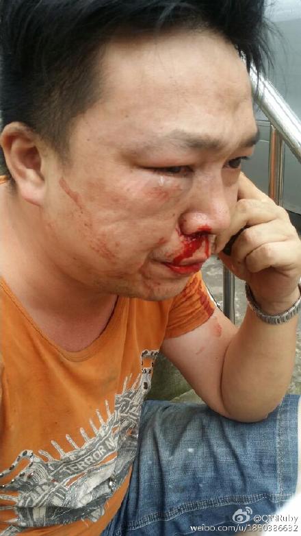 吴科佳被打后的样子。受访者供图